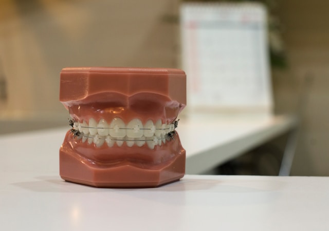 Top 5 avantaje ale aparatului dentar ceramic